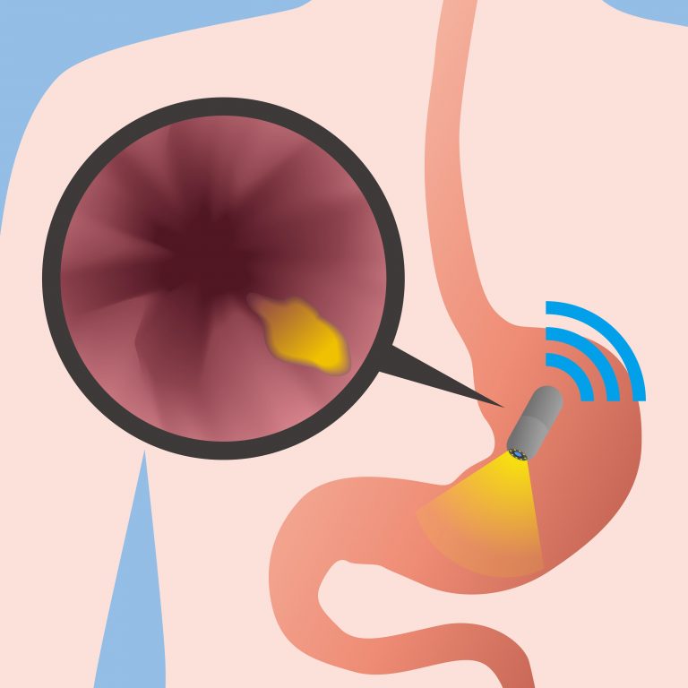 How Long Does Endoscopy Procedure Take