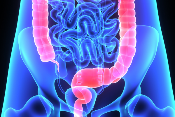 Colon cancer screening tests