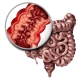 Symptoms and treatment options for Crohn's Disease and Inflammation of the Digestive Tract